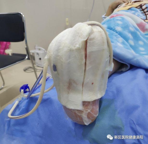 致糖友：别让糖尿病吃掉你的脚